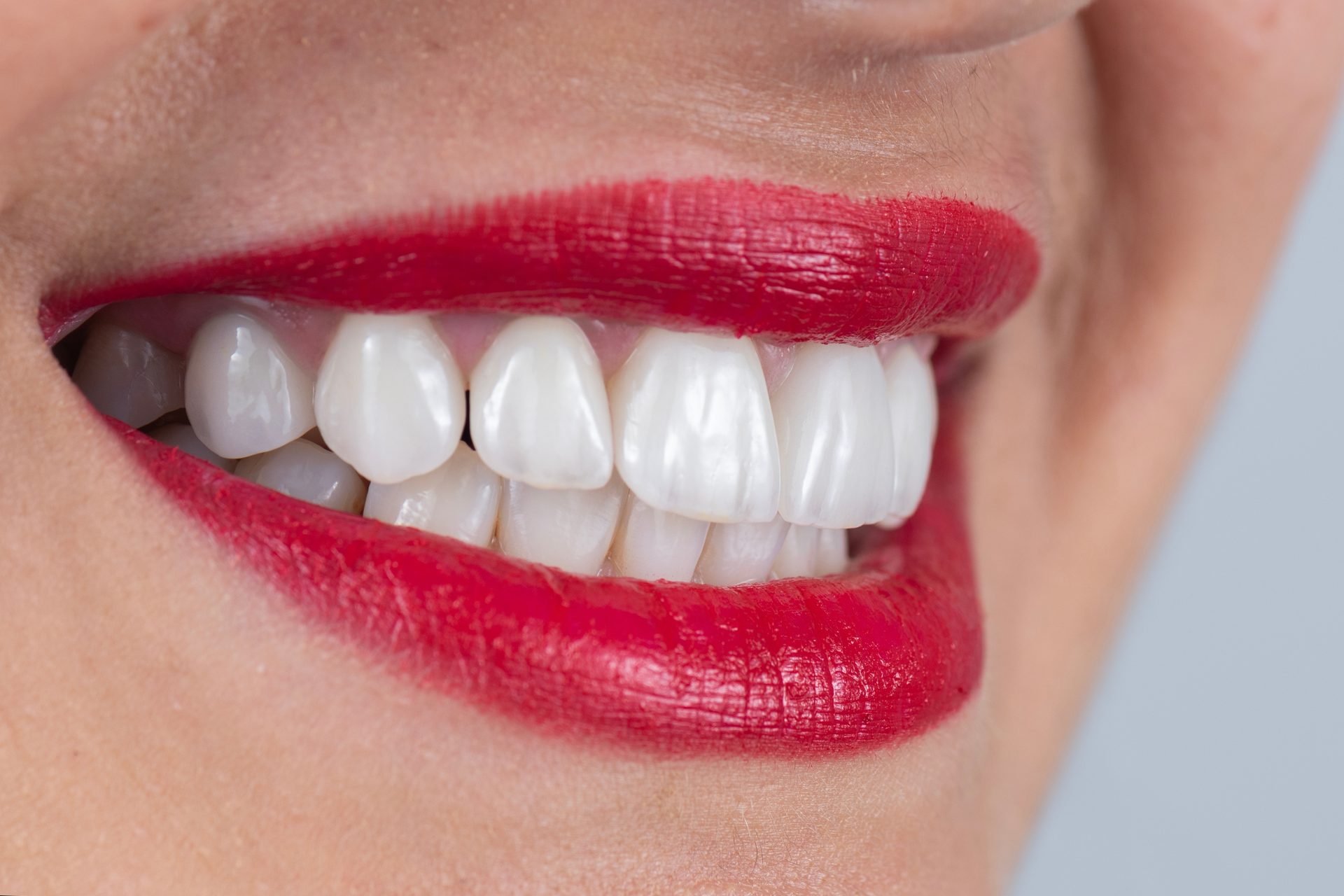 A close-up of a smile