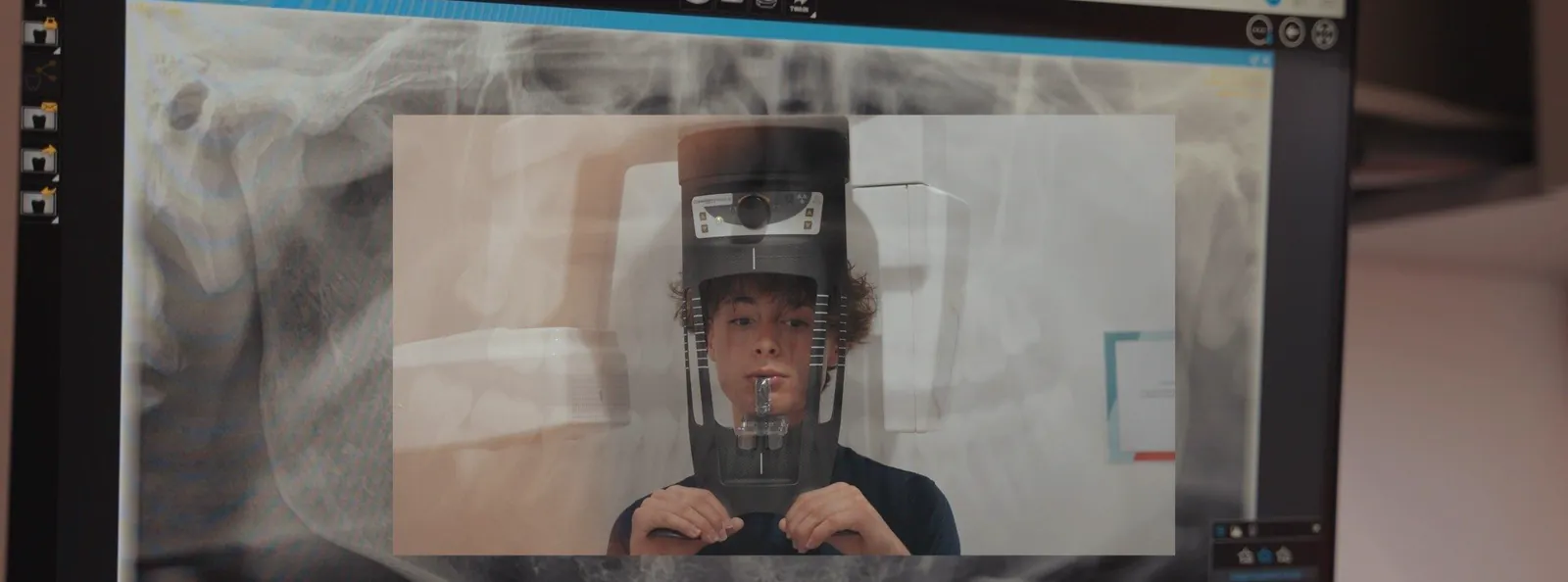 The 3D X-ray (CBCT) software at Apex Dental